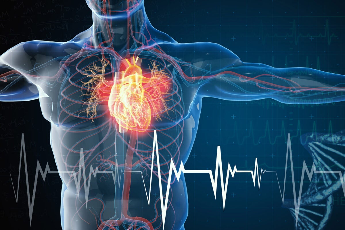 Heart Attack Prediction Model